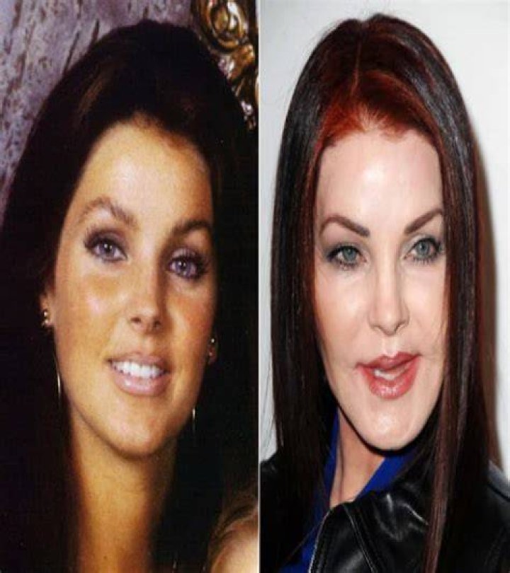 Celebrity plastic surgery disasters Fox News