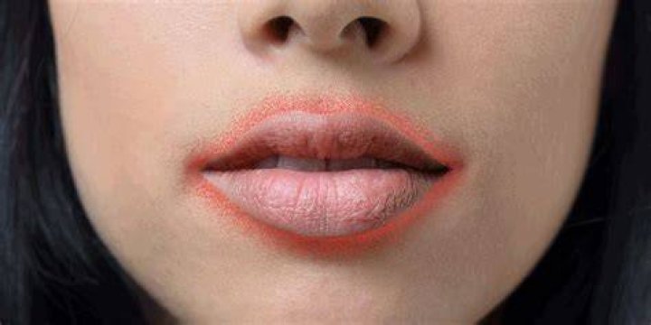 Red ring around lip Nikki Catsouras Death Photographs